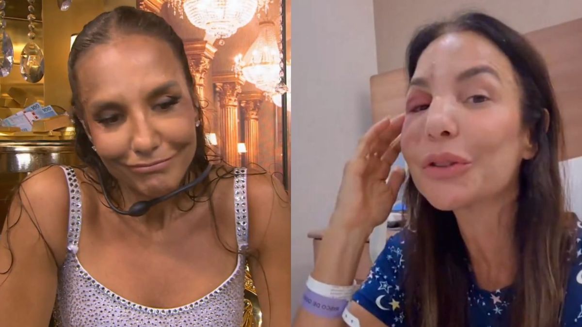 No BBB 26, Ivete Sangalo detalha acidente: “Senti a gosma de sangue”