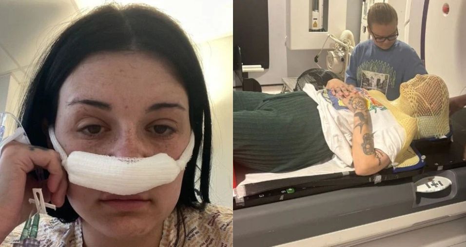 Mulher que teve sintomas tratados como estresse descobre tumor cerebral