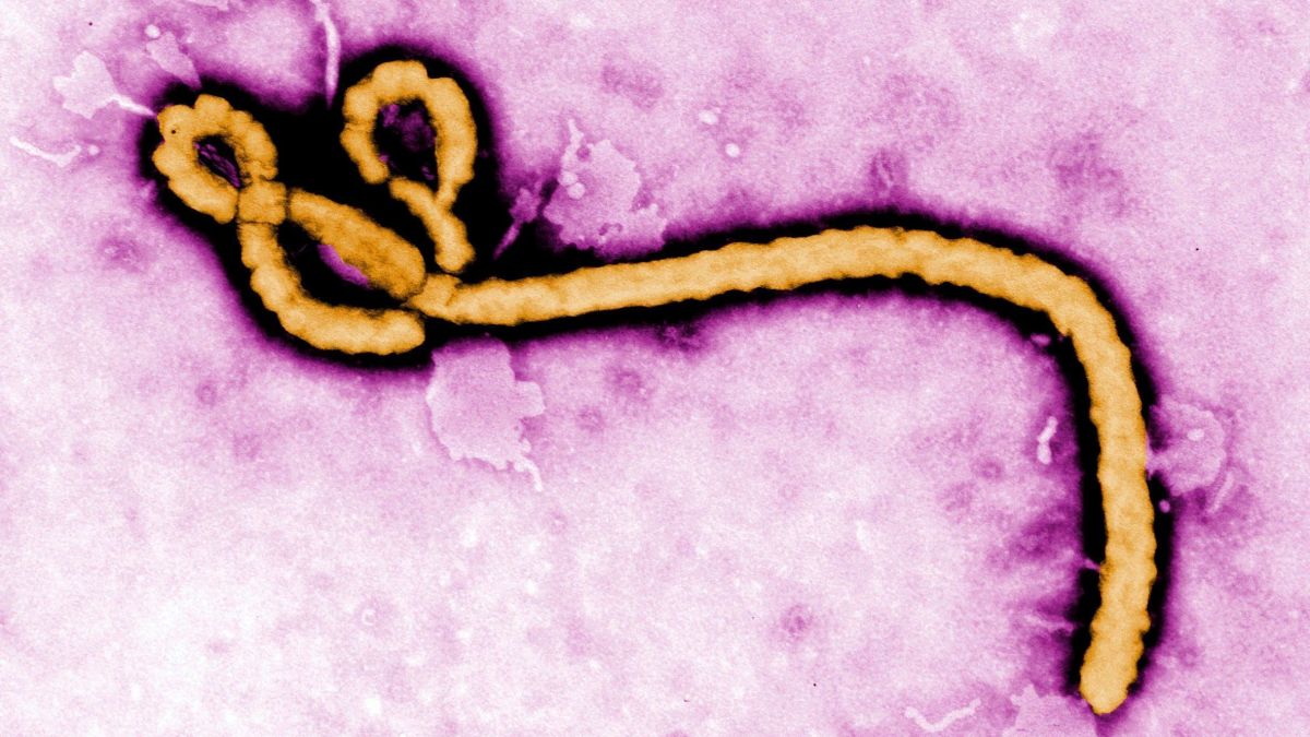 Suspeita de Ebola é descartada em paciente do Rio vindo de Uganda