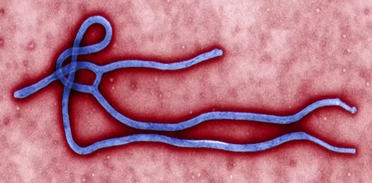 Caso suspeito de ebola é descartado em paciente no Rio Grande do Sul