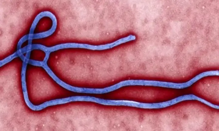 Caso suspeito de ebola é descartado em paciente no Rio Grande do Sul