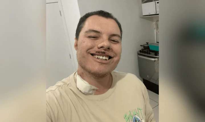 Homem agredido em festa universitária de SP é internado novamente após alta