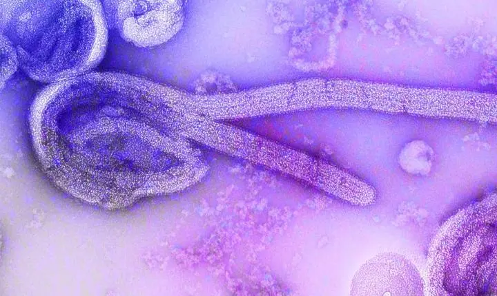 Paciente de Uganda sob suspeita de ebola testa positivo para malária no RJ