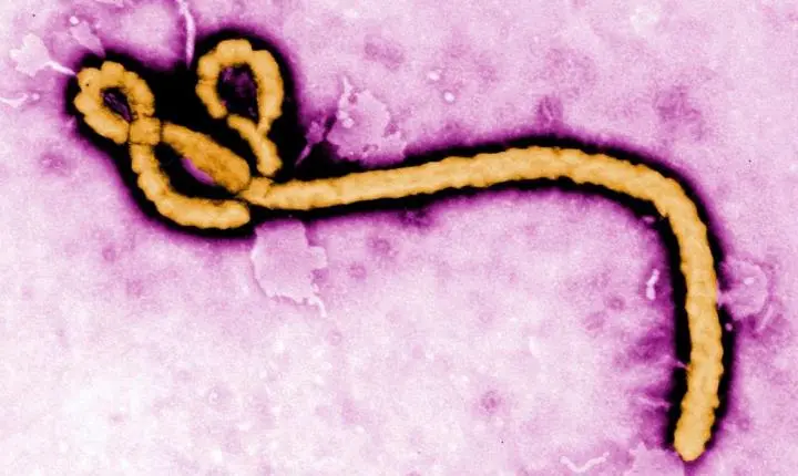 Suspeita de Ebola é descartada em paciente do Rio vindo de Uganda